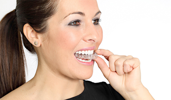 Ortodoncia invisible Invisalign bilbao